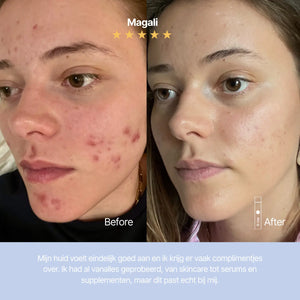 Clear skin