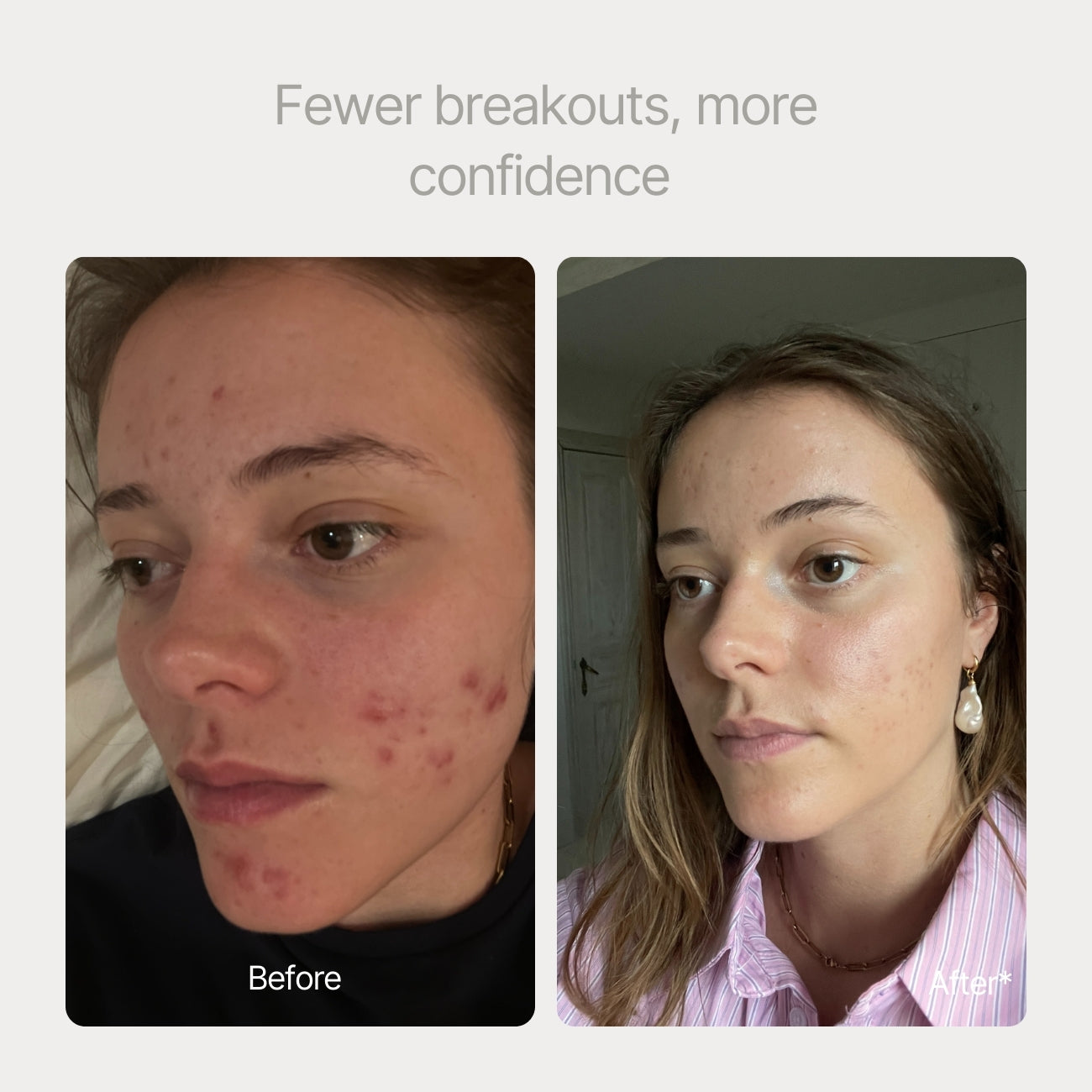 Clear skin