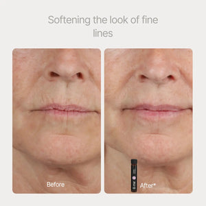 Collagen Advance+ 