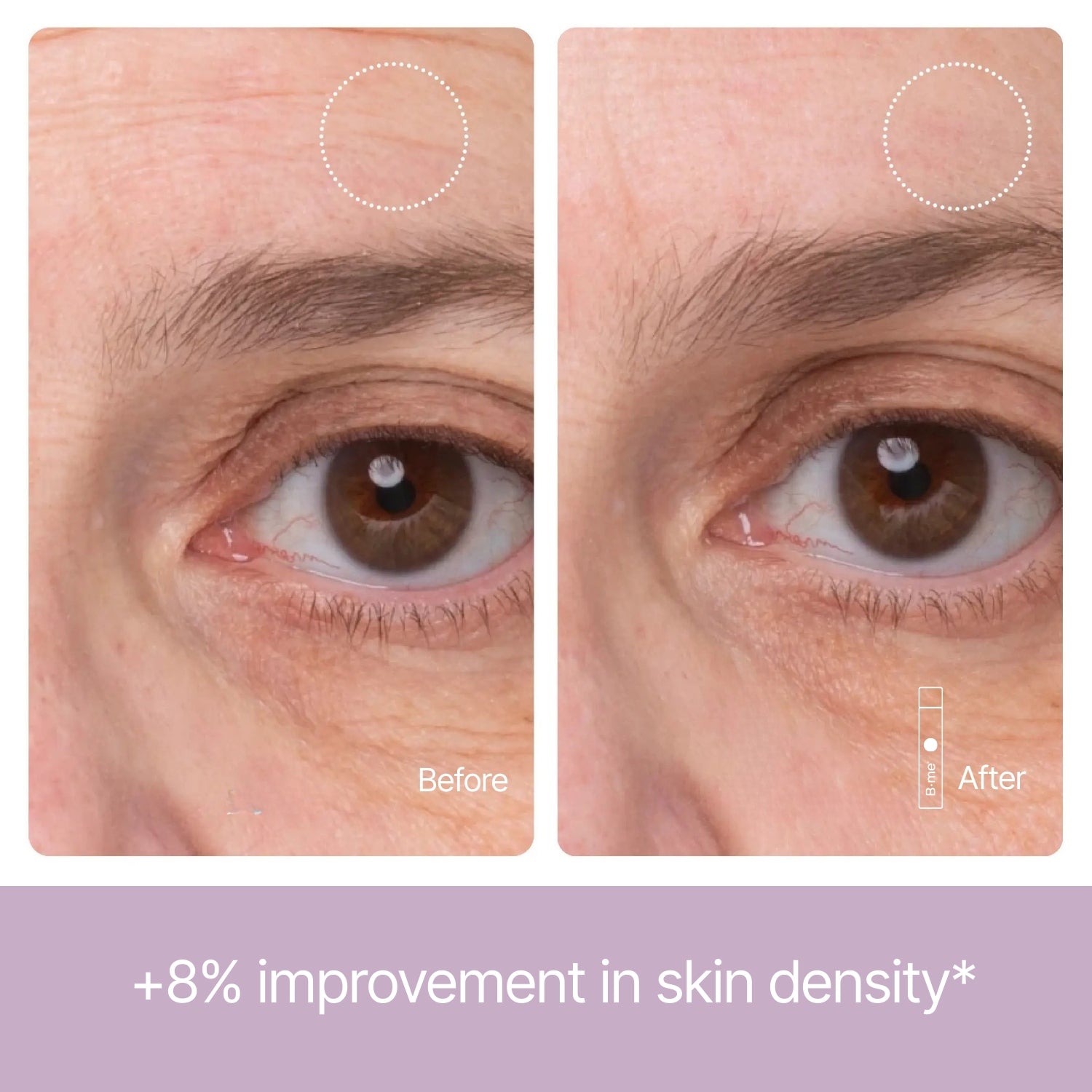 Before and after showing improved skin density and smoother skin around the eyes after using B.me Collagen Advance+